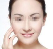 揭秘惠州市受歡迎雙眼皮手術醫(yī)院推薦TOP10