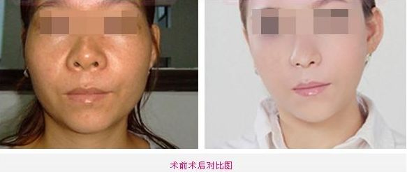 全新整容醫(yī)院推薦！這5家值得你關(guān)注