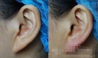 湖州哪家醫(yī)院能有效提升面部外觀？