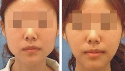 廣州中家醫(yī)家庭醫(yī)生整形美容醫(yī)院價(jià)目表及專家推薦