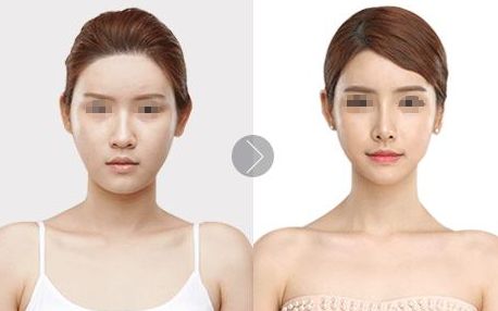 沭陽縣人民醫(yī)院燒傷外科服務(wù)及收費解析，醫(yī)生挑選技巧揭秘！