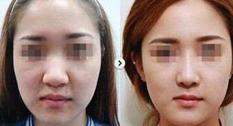 集安知名整形診所徐秀云外科口碑如何？收費標準和服務(wù)詳情揭秘