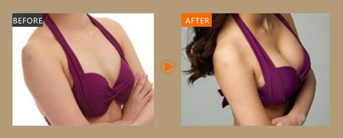 廈門疤痕去除醫(yī)生