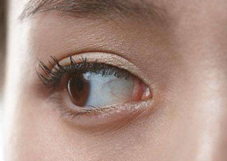 大理水光針祛細紋醫(yī)生