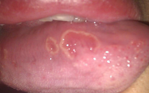 上海乳頭溝修復(fù)醫(yī)生