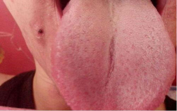 南陽PRP血膠原除皺醫(yī)生