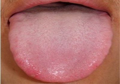 重慶微整形面部皺紋醫(yī)生