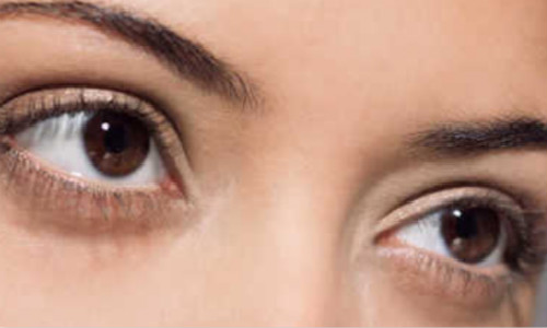 寧波點(diǎn)陣祛動態(tài)細(xì)紋醫(yī)生