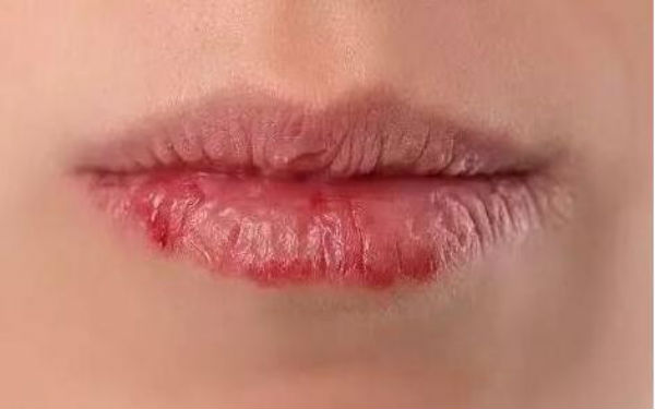 濟南下垂鼻修復(fù)醫(yī)生