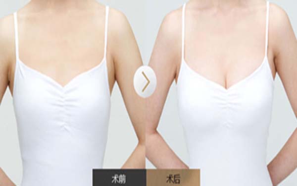 上海做內切眼袋手術醫(yī)生