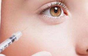 肇慶光電去除生長紋醫(yī)生