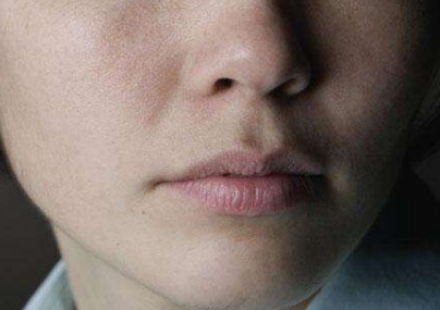 蘇州光纖溶脂祛妊娠紋醫(yī)生