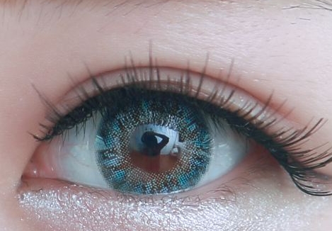 蘇州雀斑臉激光祛斑醫(yī)生