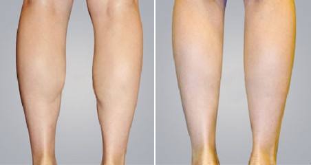 綿陽注射隆鼻修復(fù)醫(yī)生