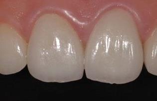 武漢面部負(fù)壓吸脂醫(yī)生