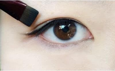 云南手術消除眼角皺紋醫(yī)生