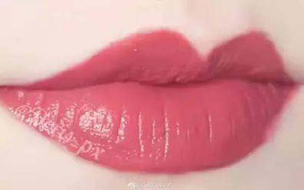 深圳點(diǎn)陣激光祛痘印醫(yī)生