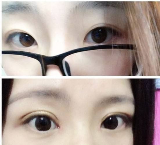 濟南非手術(shù)面部特征雕刻醫(yī)生