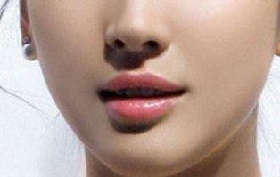 東莞祛動態(tài)細紋手術(shù)醫(yī)生