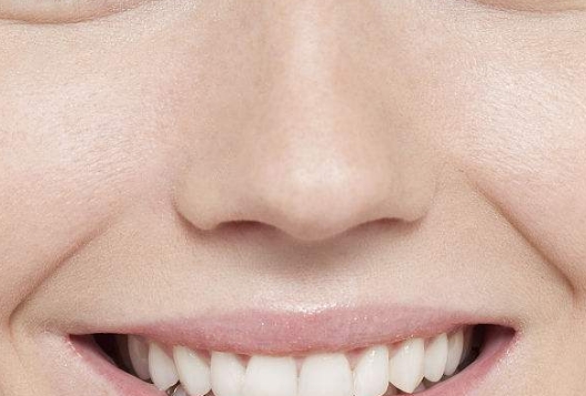 南京黃金微雕面部醫(yī)生