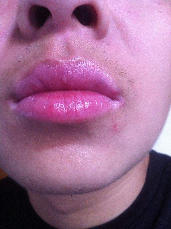 南京手術消除眼底靜態(tài)紋醫(yī)生