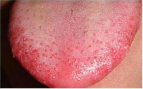 蘭州多維分層定向吸脂術(shù)醫(yī)生