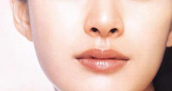 西安面頰填充玻尿酸醫(yī)生