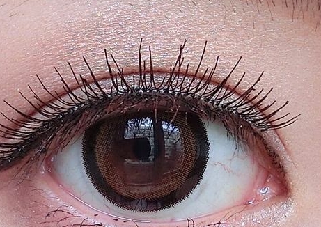 東莞眼袋填充細(xì)胞醫(yī)生