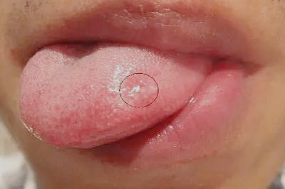 濮陽激光去細紋醫(yī)生