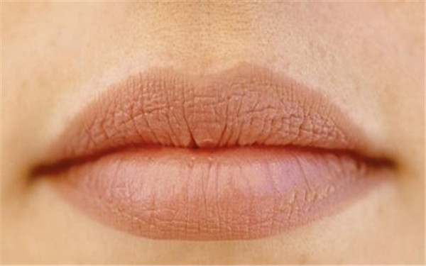 成都干細(xì)胞去口周紋醫(yī)生