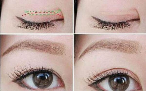 2023年臨沂市治療色斑好的醫(yī)療機(jī)構(gòu)比較，一個(gè)新的醫(yī)院排名榜發(fā)布！公立、私立醫(yī)院對(duì)比分析結(jié)果-最新報(bào)價(jià)一