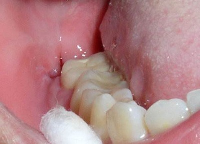 2023南寧地區(qū)五家頂尖牙科醫(yī)院排名揭曉，備受贊譽(yù)！