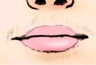 2023年上海七家面部抽脂專(zhuān)科醫(yī)院一覽