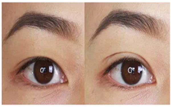 2023年亳州地區(qū)最受矚目的吸脂手術(shù)醫(yī)院盤點(diǎn)，前三強(qiáng)醫(yī)院非常值得關(guān)注！