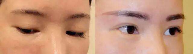 2023年上海好口碑的種植牙醫(yī)院推薦！看看這幾家醫(yī)院的技術如何！