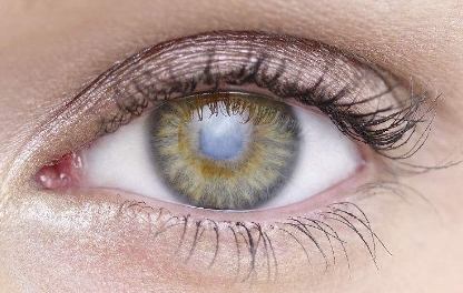 2023年廣州市頭發(fā)移植醫(yī)院排行榜：最好的醫(yī)院居首，引領新潮流！