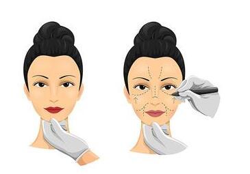 2023年國內(nèi)有哪些公立醫(yī)院提供美容整形服務？整形醫(yī)院排行榜公布！