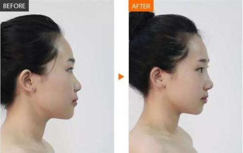 2023年成都做鼻部整形手術(shù)的專家名單公布，了解最可靠的整形醫(yī)生！