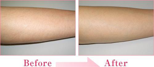 2023年成都脂肪抽吸手術(shù)頂級醫(yī)院盤點！這五家技能超群！