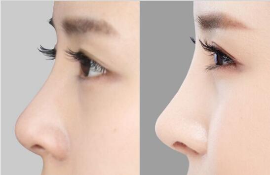 2023年紹興市頂級(jí)美容醫(yī)院排行榜：享譽(yù)口碑的機(jī)構(gòu)盤點(diǎn)，整形福音收錄！