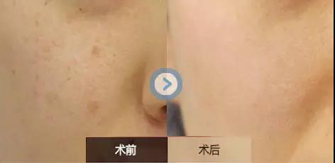 沈陽美膚祛斑醫(yī)生