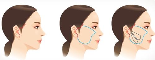 2023年淮安整形醫(yī)院近五年中綜合回顧，美麗殿堂華麗揭幕，蘇王獨領(lǐng)前列！