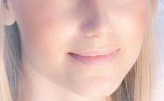 太原鼻基底填充熊貓針醫(yī)生