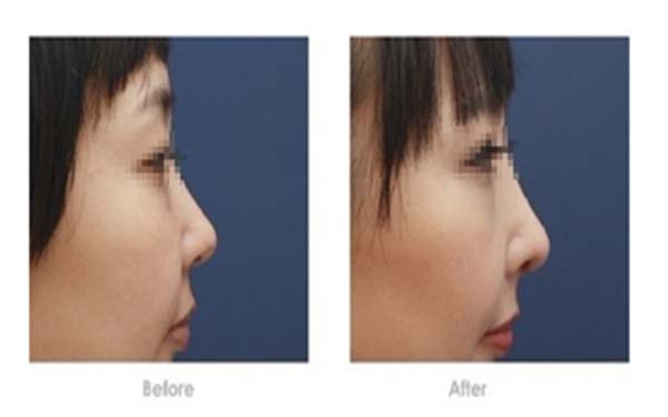 2023年長沙頂級整形醫(yī)院盤點(diǎn)：卓越、芳華、華麗居榜單前列！