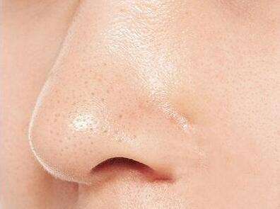 珠海填充眼角紋凹陷醫(yī)生