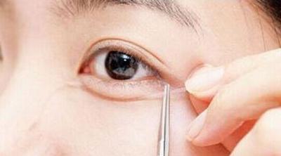 7月五家重慶有名氣的整形醫(yī)院優(yōu)惠價大比拼！整容專家曬出匯總單，誰是冠軍？