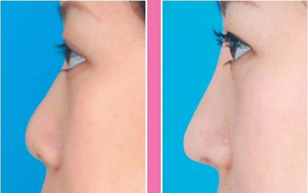 九院醫(yī)生推薦：無論是李青峰還是張余光，都是面部提升領(lǐng)域的頂尖專家！