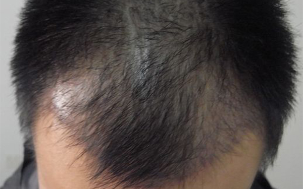 臨沂公立口腔醫(yī)院一覽：多家機(jī)構(gòu)備受贊譽(yù)，靠譜口碑讓您舉措輕松！確?？谇唤】?，快速選擇最佳！