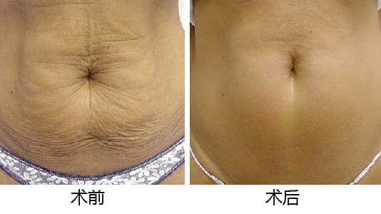 義烏整形醫(yī)院優(yōu)選TOP5，專業(yè)權(quán)威推薦，如何做出準(zhǔn)確選擇？深入了解為上策