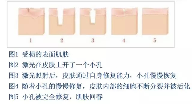 樂山整形美容院推薦！想在樂山做整形的話，這些建議不容錯(cuò)過！